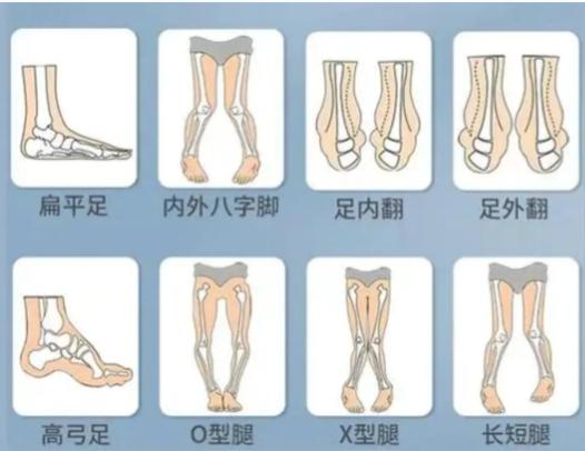 2. 审美风格:追求自然的“原生直”www.aimei.com