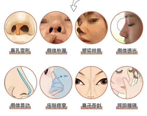 二、王旭东鼻修复价格表:不同医院的项目分类与价格差异
