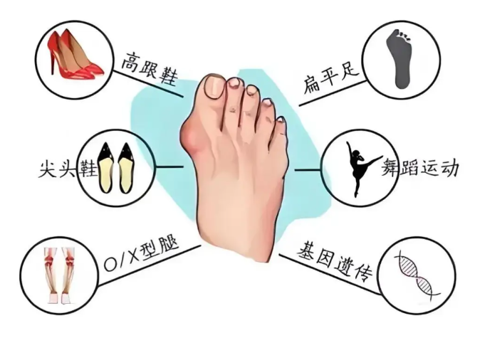 三、 徐州耿兴田诊疗计价闭环：如何杜绝足部整形中的“二次收费”套路？