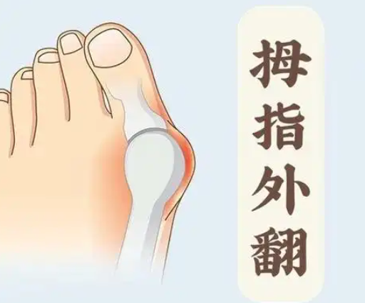 六、 关于徐州耿兴田做大脚骨及技术靠谱度的深度问答