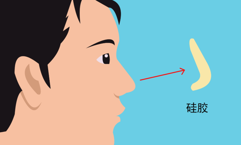三、除了价格,找沈阳袁继龙做隆鼻你还需要知道这些