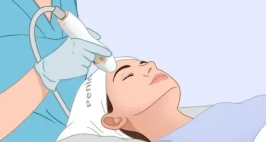 三、如何选择：超声炮与光子嫩肤的对比与决策指南