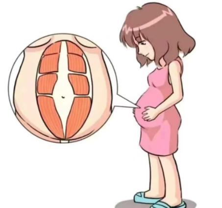 六、广州郑子良医生腹壁整形全流程指南（避坑点）