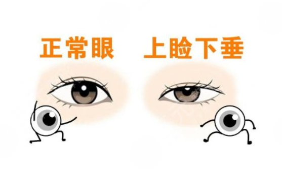 三、全方面解读郑永生眼袋修复项目