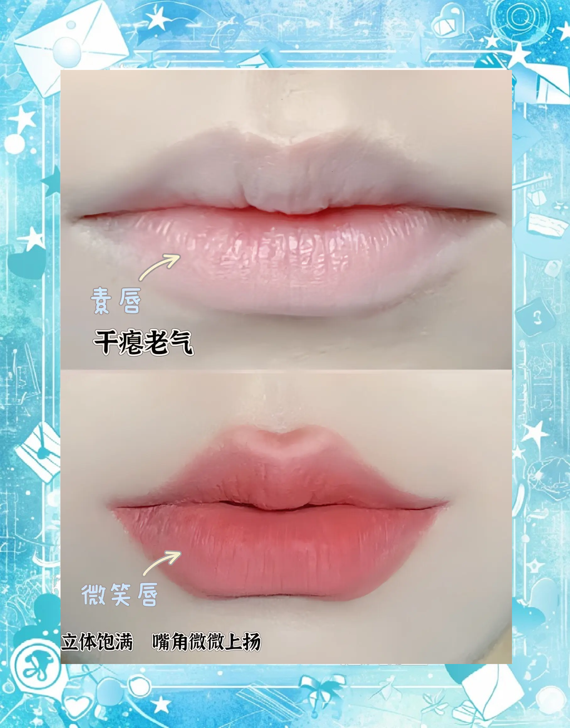 一、赵久丽微笑唇手术成效分享：术后三个月，不笑也自带亲和力，真的太减龄了！