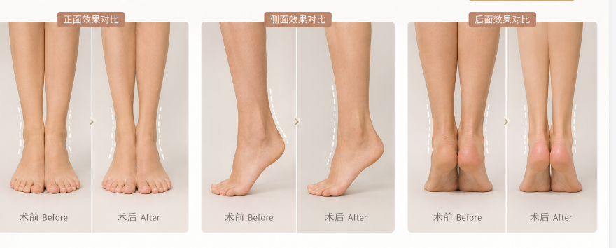 三、杭州10家热门吸脂机构综合对比与价格解析