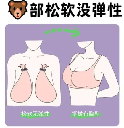 2. 针对产后下垂的多维矫正