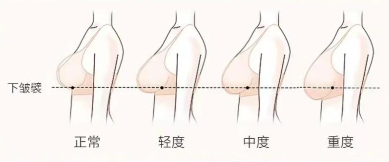 1. 术后变好期与心理预期www.aimei.com