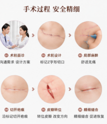 广州曙光蒋水清疤痕修复靠谱吗?华南标杆!独创多维隐痕平疤术实现功能与外观双重修复