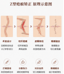 三、蒋水清增生疤痕修复价格与就诊指南www.aimei.com