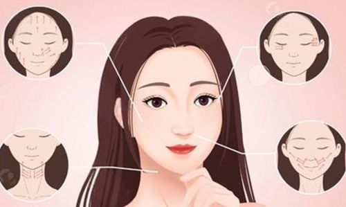 八大处侯典举做拉皮怎么样?主任医师,从业近40年,全脸大拉皮6万-9万!