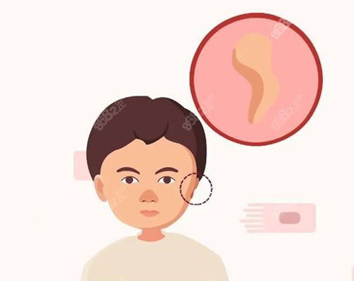 韩国郑在皓院长如何?20年耳再造案例真绝了!江南区专家真实口碑揭秘