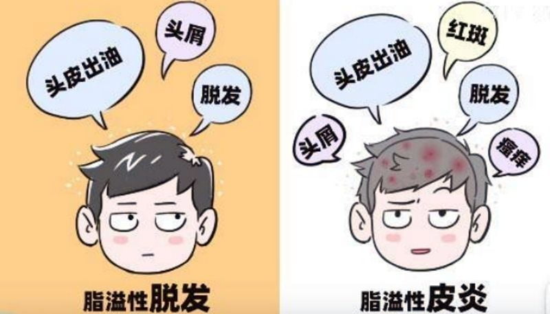 三、给真想去温州邱立政植发的朋友几点实在建议