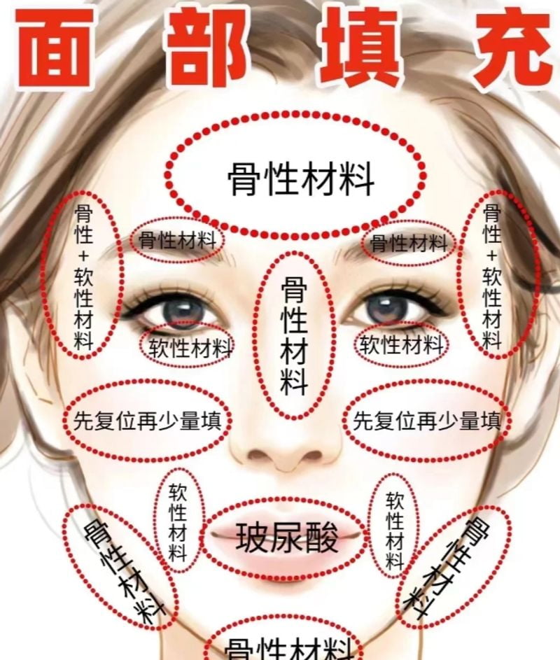 如何选择技术与医生？关键点剖析