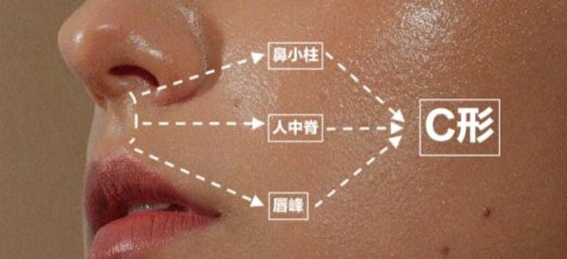 成都冯春雨人中三件套价格2.8万起！冯春雨上唇缩短+鼻唇沟填+红唇修薄三件套价格2.8万+，按畸形复杂度定