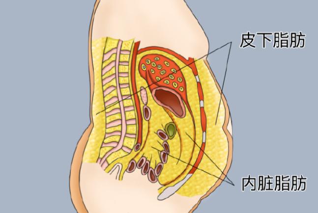 如何选择最适合你的腹壁成形术医生？
