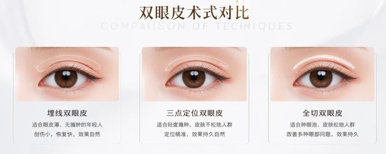 二、什么样的人，才真正适合做微创双眼皮7.5毫米平扇？