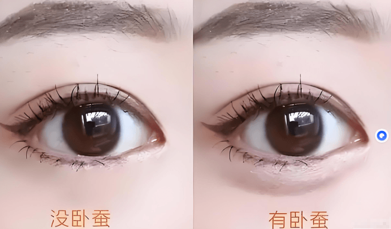四、关于成都赫拉臻颜的常见问题Q&Awww.aimei.com