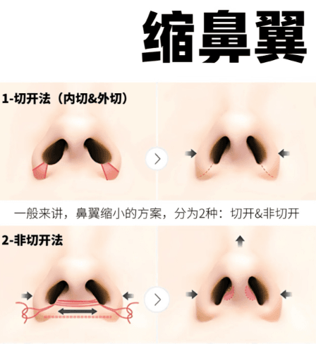 太原隆鼻哪家医院做得好？推荐4家技术好审美在线医院