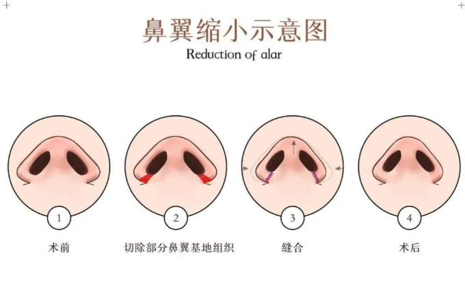 二、杨晓松的技术牛在哪?为什么都说他打爱贝芙稳?