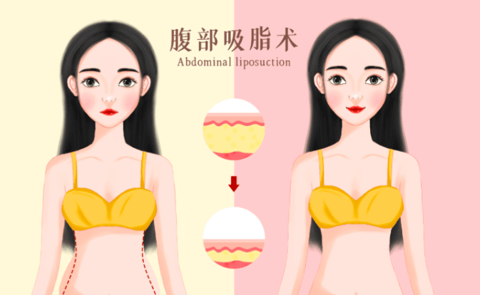 三、面诊郑州星格张叶鹏医生，我必须问清楚哪些问题？