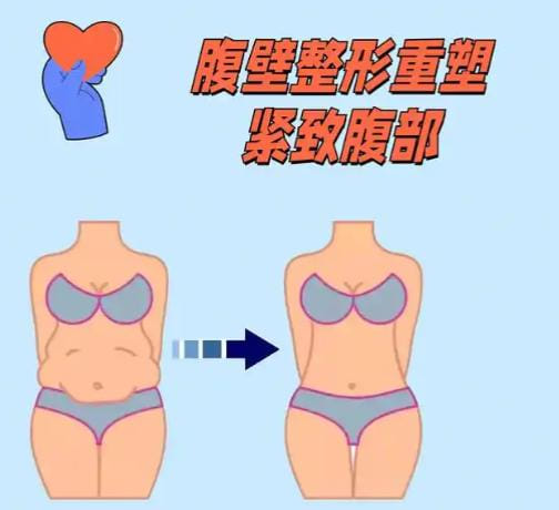 五、腹壁整形医生李献和面诊人多吗？真实预约流程与渠道