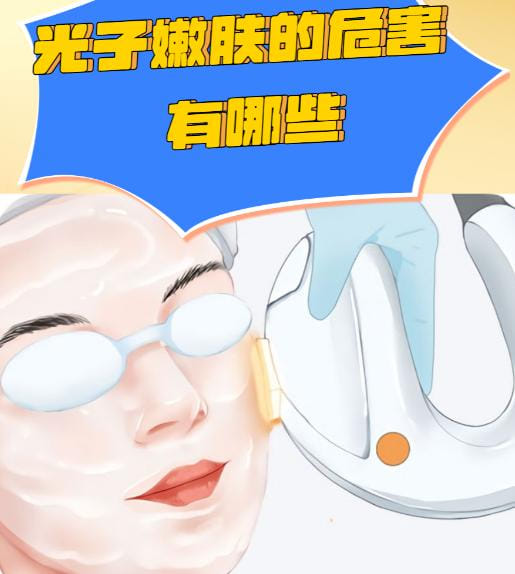 四、除了价格，做光子嫩肤前你必须知道的几件事