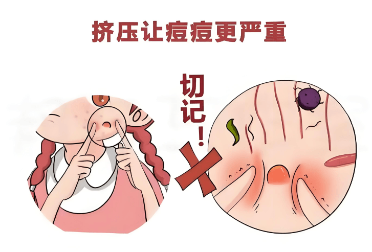 二、探访佛山华美:祛痘淡印常用技术设备与项目解析