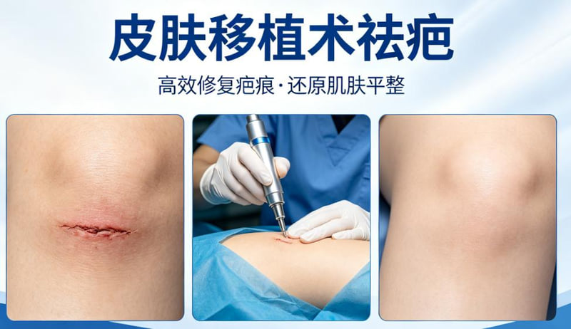 四、如何判断自己是否适合在佛山华美进行祛疤治疗?www.aimei.com