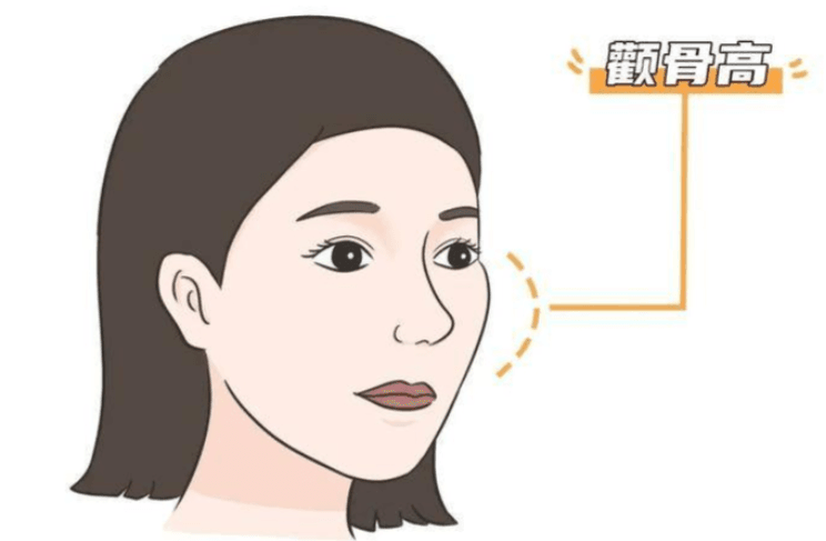 五、避坑指南:颧骨内推术前必须明确的决策细节