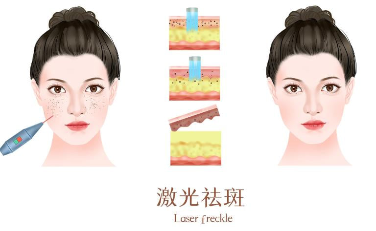 Q5：为什么美卫士上的价格比某些小诊所给的价格低，又比某些“美容院”高？