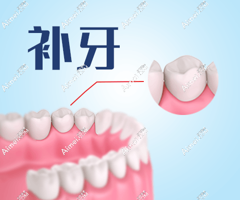 补牙.png