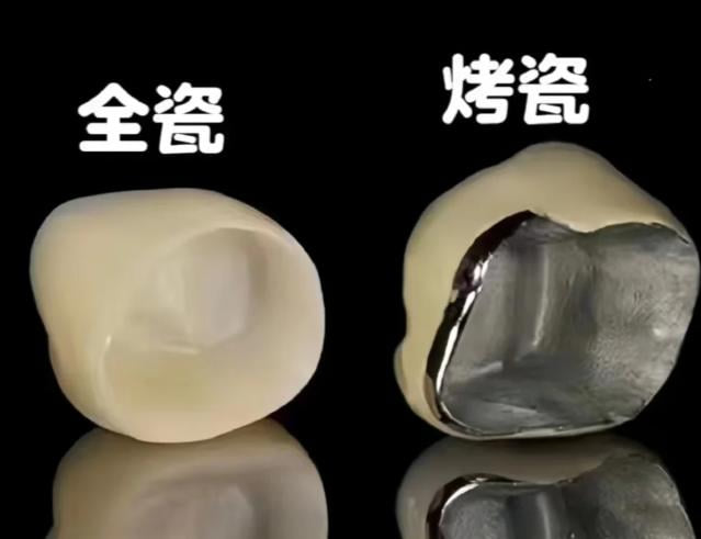 网上 300 元一颗的烤瓷牙怎么样,在天津做完省下好几千,必须去贝色小程序锁定(天津中诺、美奥、中牙)这几家医院!