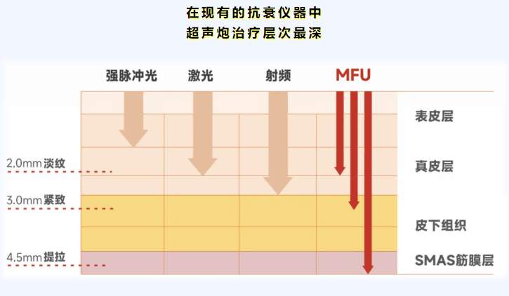 四、关于超声炮,你可能还想知道这些