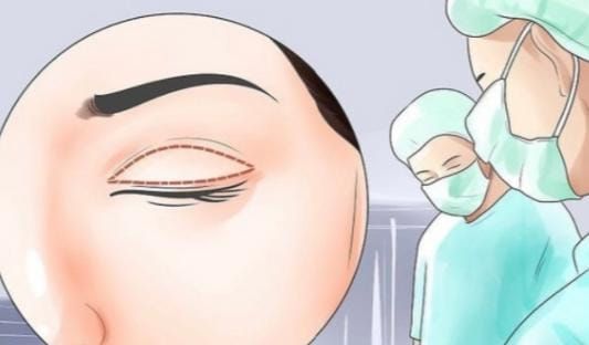 成都纯曦林靖医生靠谱吗？价格透明眼修复1万起面诊人多