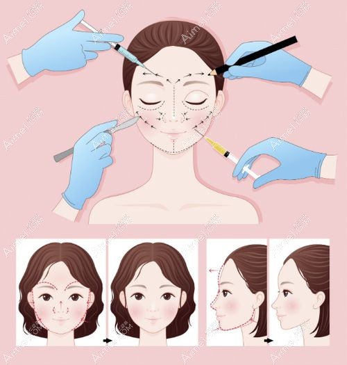 泉州欧菲李威医生.jpg 泉州欧菲李威医生.jpg