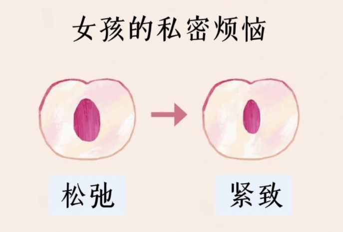 1. 阴道紧缩术(热门成单项目)