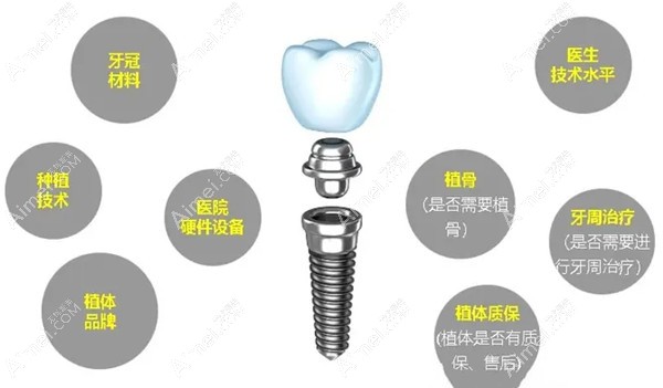 准备去鼎植口腔种牙？先上贝色查好收费，再领看牙优惠券，省的都是真金白银