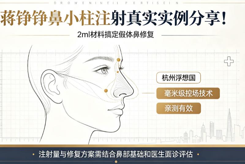 蒋铮铮鼻小柱注射真实实例分享！2ml材料搞定假体鼻修复，杭州浮想国毫米级控场技术亲测有效！