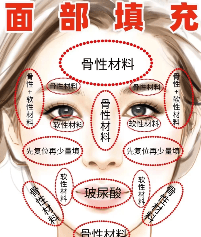 三、关于杭州丽脂吸脂的常见疑问解答(Q&A)